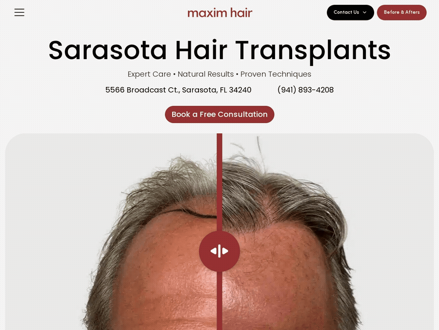 Dr. Kristopher Hamwi — MAXIM Hair Restoration, Sarasota FL